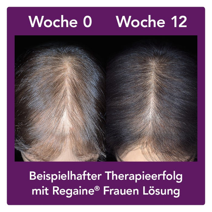 Regaine Frauen Lösung, 60 ml Solution